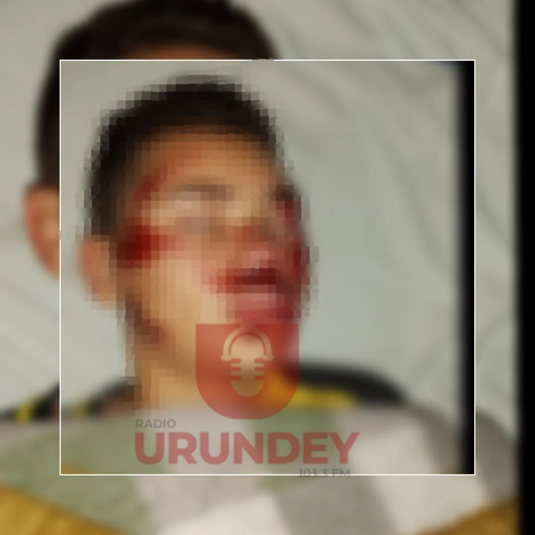 Motociclista atropella a un menor en Bella Vista Norte y huye, dejándolo en grave estado