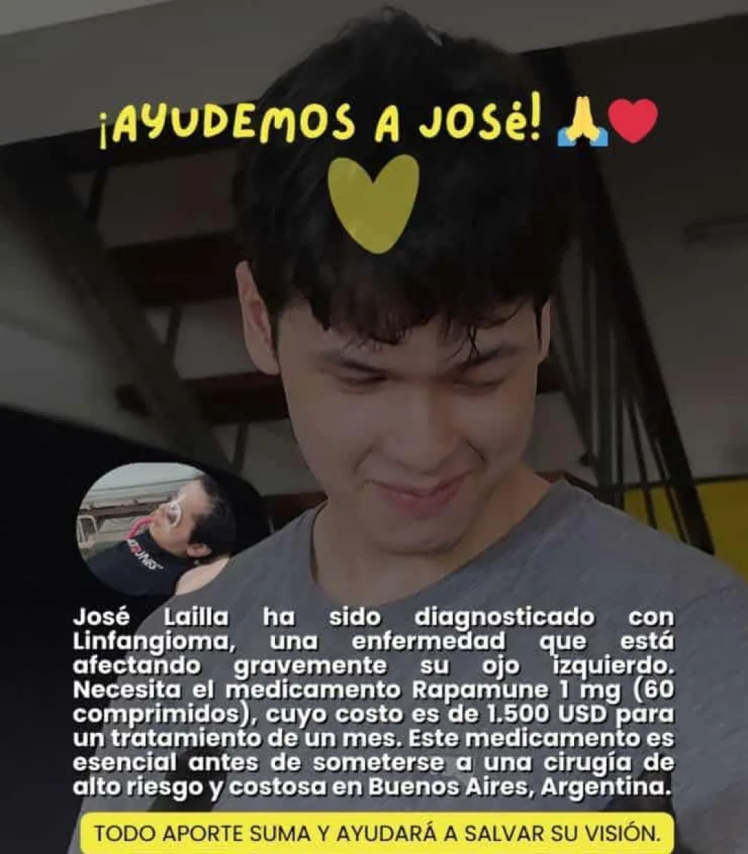PJC: Joven necesita un medicamento y cirugía costosos para tratar de una enfermedad de la vista